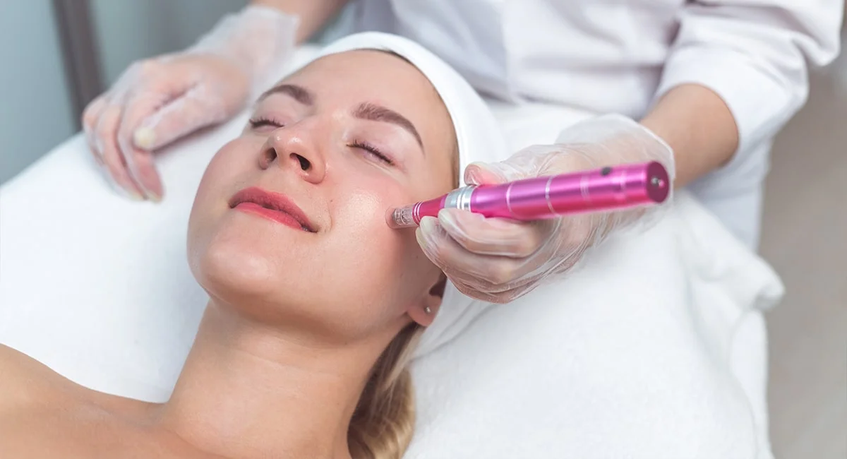 Micro-Needling Behandlung bei Pure Cosmetic Cottbus